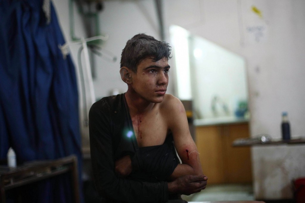 Ο φωτογράφος Αbd Doumany συνέχισε το ρεπορτάζ του από τον πόλεμο στη Συρία αυτή την εβδομάδα. Εδώ, ένα τραυματισμένο αγόρι περιθάλπτεται σε ένα αυτοσχέδιο νοσοκομείο στην ελεγχόμενο από αντάρτες προάστιο της Δαμασκού, Δούμα.Την τελευταία εβδομάδα αναφέρθηκαν δύο αεροπορικές επιδρομές των κυβερνητικών δυνάμεων. Το προπύργιο των ανταρτών της Δούμα ήταν υπό πολιορκία από τις δυνάμεις της κυβέρνησης για περισσότερο από ένα χρόνο, με τους κατοίκους να αντιμετωπίζουν σοβαρές ελλείψεις σε τρόφιμα και ιατρικές προμήθειες. Photograph: Abd Doumany/AFP/Getty